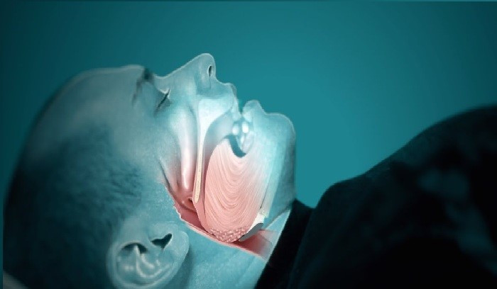 What is apnea
